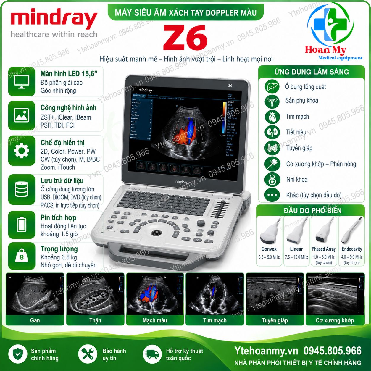 Bảng gi&aacute; m&aacute;y si&ecirc;u &acirc;m x&aacute;ch tay cập nhật mới nhất - SonoScape, VINNO, Mindray, Chison, Dawei